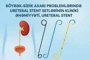 Böyrək–Sidik Axarı Problemlərində Ureteral Stent Setlərinin Kliniki Əhəmiyyəti, Ureteral Stentlərin İş Prinsipi və Tətbiqi